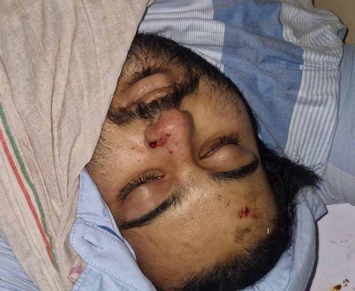 అతీక్ అహ్మద్ చిన్న కుమారుడు రోడ్డు ప్రమాదంలో మృతి